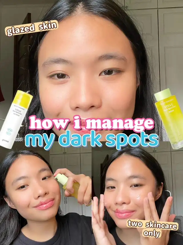how i manage my dark spots